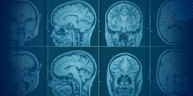 CT Scan & Panoramic X-rays